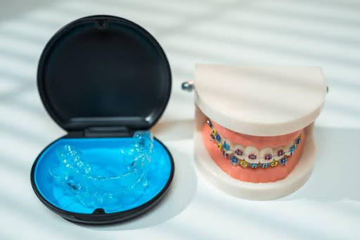 Transparent dental aligners on the table