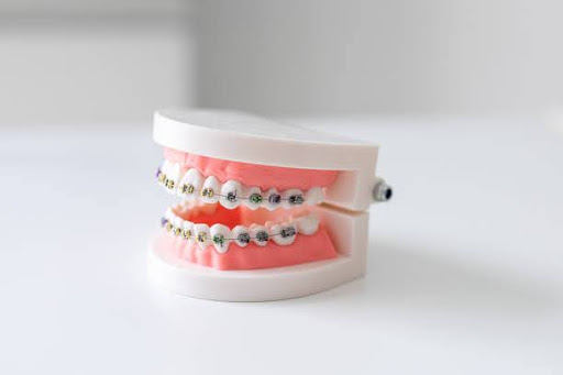 Plastic dental model with braces and dentures - Buenos Aires - Argentina